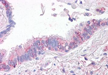Immunohistochemistry (Formalin/PFA-fixed paraffin-embedded sections) - Anti-SLC31A1 / CTR1 antibody (AB133385)