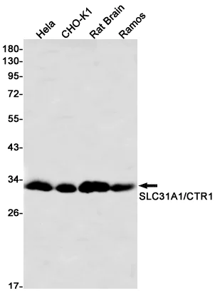 Western blot - Anti-SLC31A1 / CTR1 Antibody [S06-7G0] (AB317432)