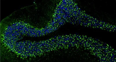 Immunohistochemistry (Formalin/PFA-fixed paraffin-embedded sections) - Anti-Slc32a1 antibody [L118/80] - Chicken IgY (Chimeric) (AB325660)