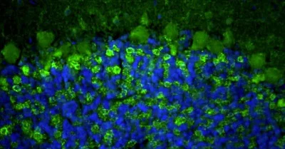 Immunohistochemistry (Formalin/PFA-fixed paraffin-embedded sections) - Anti-Slc32a1 antibody [L118/80] - Chicken IgY (Chimeric) (AB325660)