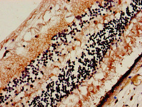 Immunohistochemistry (Formalin/PFA-fixed paraffin-embedded sections) - Anti-SLC32A1/VGAT antibody (AB235952), expandable thumbnail