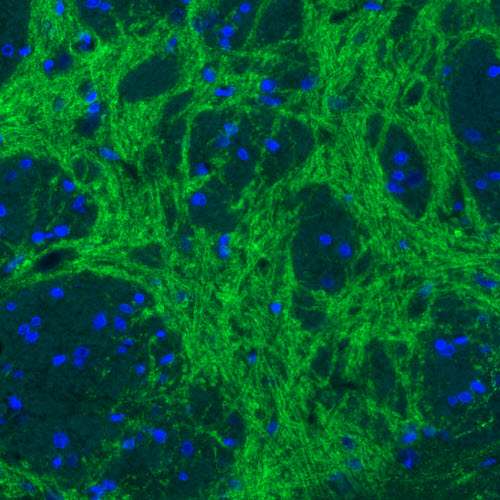 Immunocytochemistry - Anti-SLC32A1/VGAT antibody [CL2793] (AB211534), expandable thumbnail