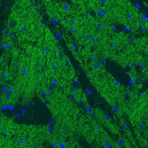 Immunocytochemistry - Anti-SLC32A1/VGAT antibody [CL2793] (AB211534), expandable thumbnail