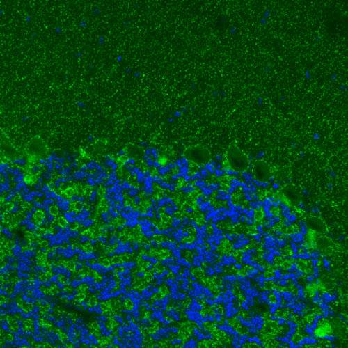 Immunocytochemistry - Anti-SLC32A1/VGAT antibody [CL2793] (AB211534), expandable thumbnail
