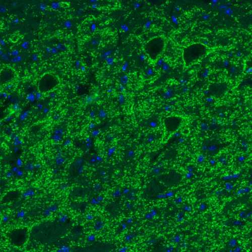 Immunocytochemistry - Anti-SLC32A1/VGAT antibody [CL2793] (AB211534), expandable thumbnail