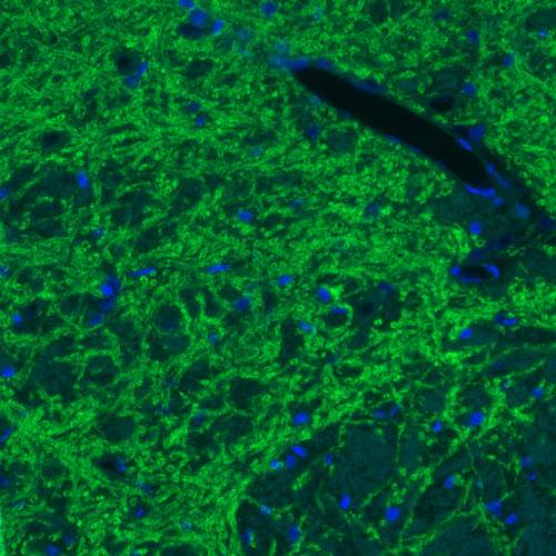 Immunocytochemistry - Anti-SLC32A1/VGAT antibody [CL2793] (AB211534), expandable thumbnail