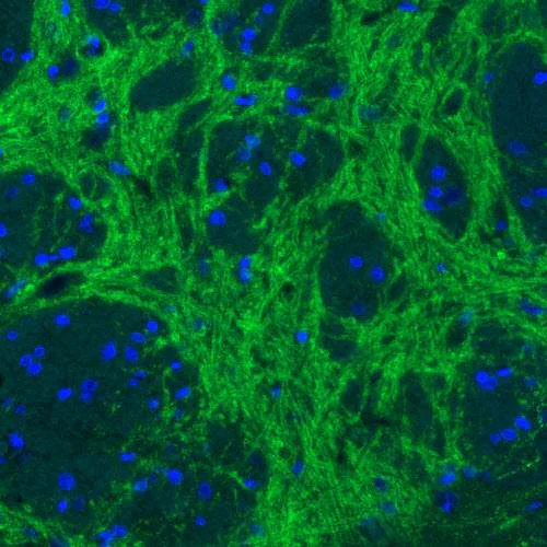 Immunofluorescence - Anti-SLC32A1/VGAT antibody [CL2793] (AB211534)