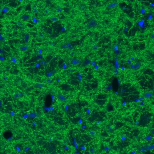 Immunofluorescence - Anti-SLC32A1/VGAT antibody [CL2793] (AB211534)