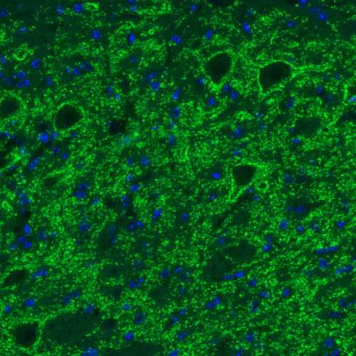 Immunofluorescence - Anti-SLC32A1/VGAT antibody [CL2793] (AB211534)