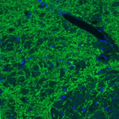 Immunofluorescence - Anti-SLC32A1/VGAT antibody [CL2793] (AB211534)
