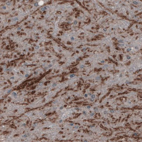 Immunohistochemistry (Formalin/PFA-fixed paraffin-embedded sections) - Anti-SLC32A1/VGAT antibody [CL2793] (AB211534)