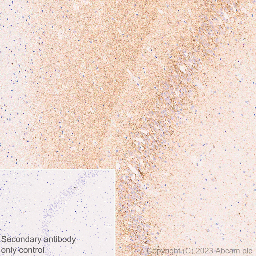 Immunohistochemistry (Formalin/PFA-fixed paraffin-embedded sections) - Anti-SLC32A1/VGAT antibody [EPR26258-9] (AB308062), expandable thumbnail