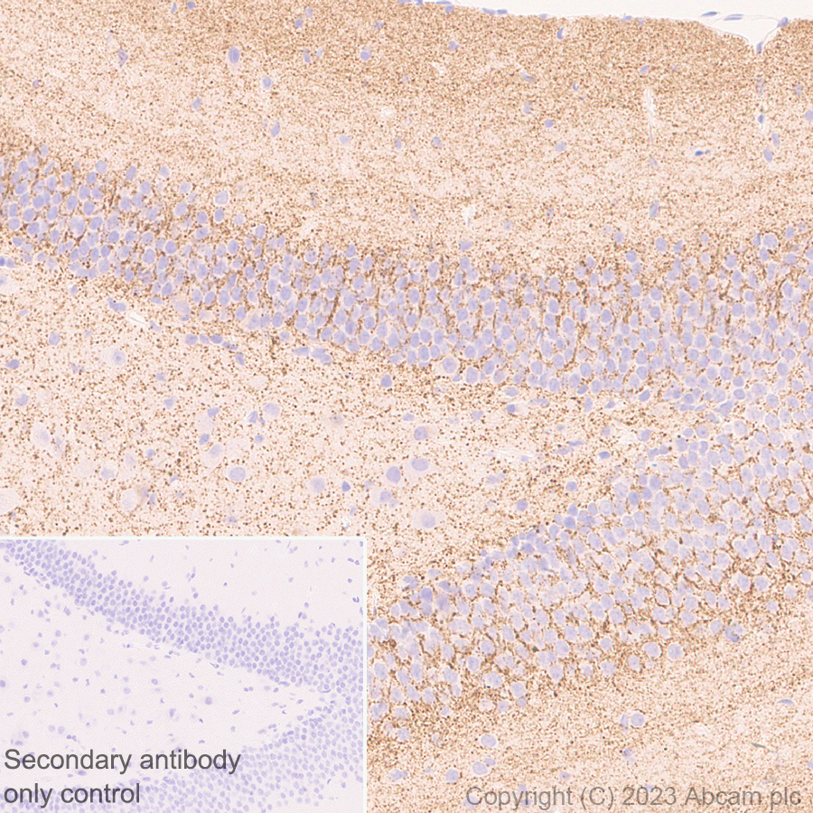 Immunohistochemistry (Formalin/PFA-fixed paraffin-embedded sections) - Anti-SLC32A1/VGAT antibody [EPR26258-9] (ab308062), expandable thumbnail