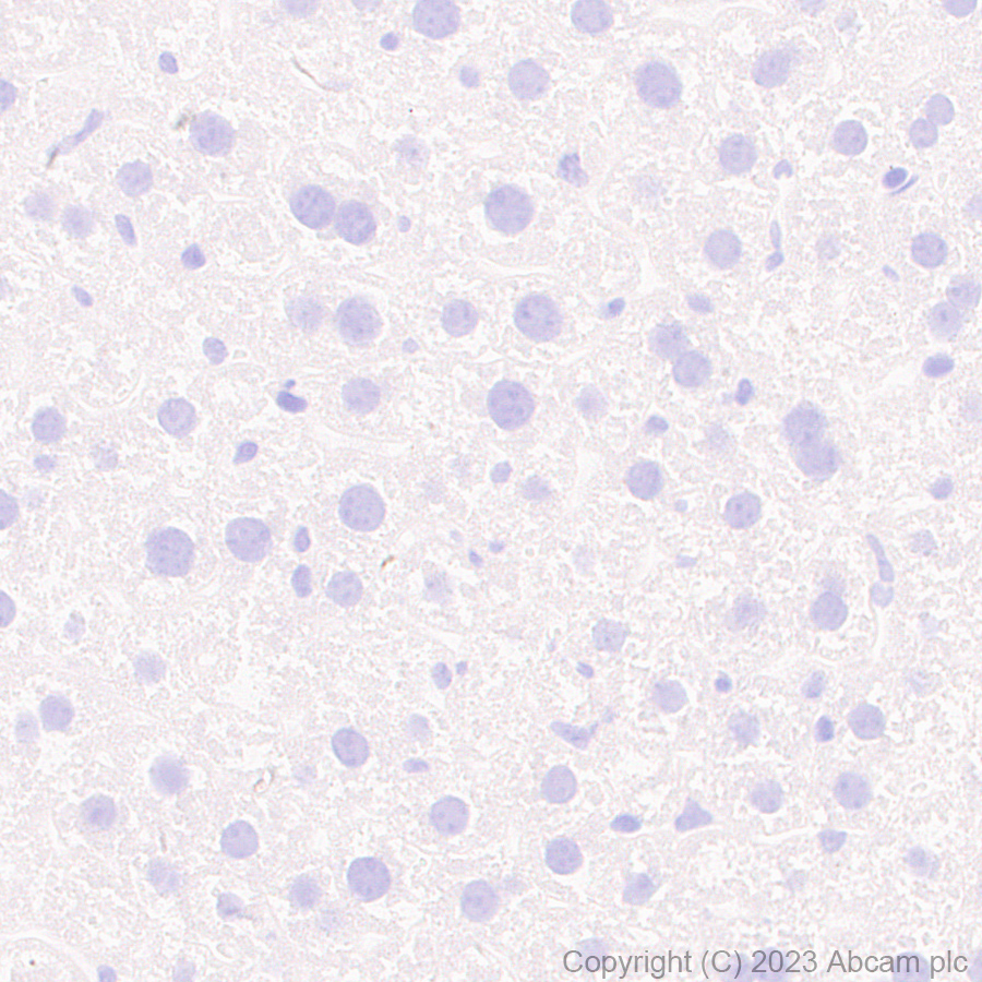 Immunohistochemistry (Formalin/PFA-fixed paraffin-embedded sections) - Anti-SLC32A1/VGAT antibody [EPR26258-9] (ab308062), expandable thumbnail