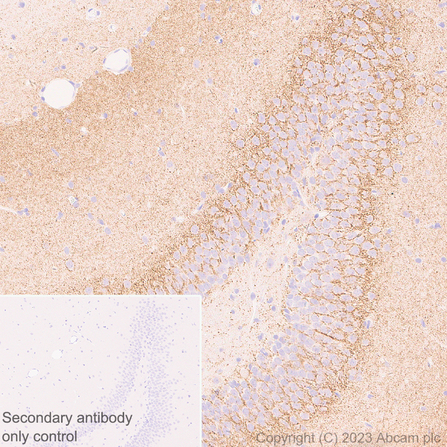 Immunohistochemistry (Formalin/PFA-fixed paraffin-embedded sections) - Anti-SLC32A1/VGAT antibody [EPR26258-9] (AB308062), expandable thumbnail