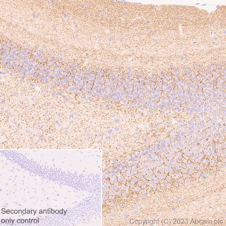 Immunohistochemistry (Formalin/PFA-fixed paraffin-embedded sections) - Anti-SLC32A1/VGAT antibody [EPR26258-9] - BSA and Azide free (AB308063)