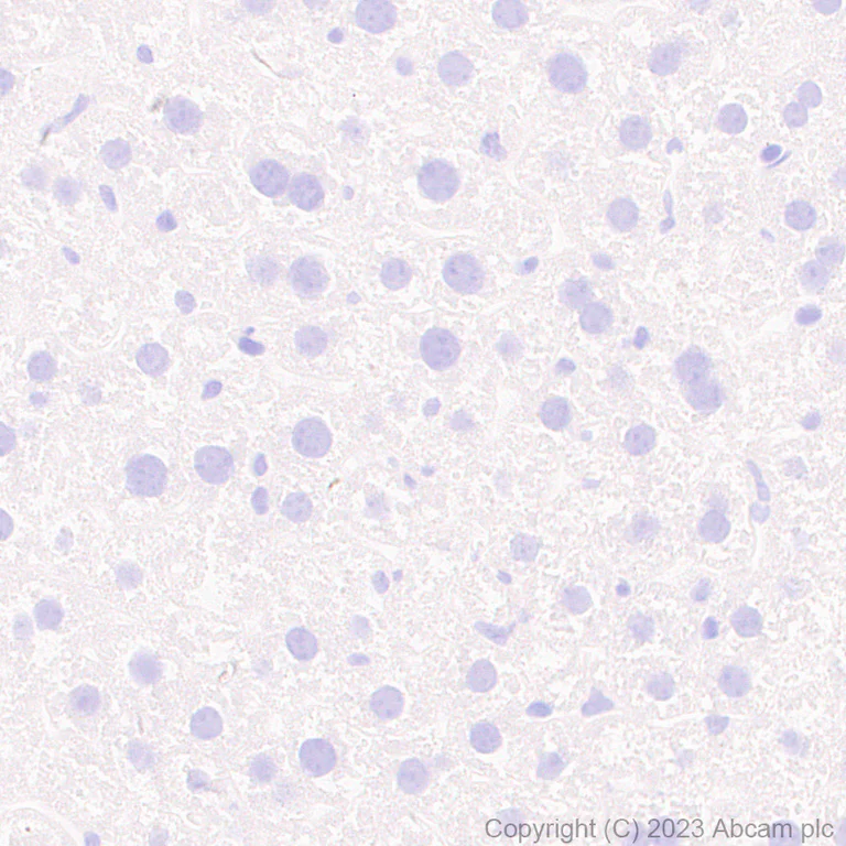 Immunohistochemistry (Formalin/PFA-fixed paraffin-embedded sections) - Anti-SLC32A1/VGAT antibody [EPR26258-9] - BSA and Azide free (AB308063)