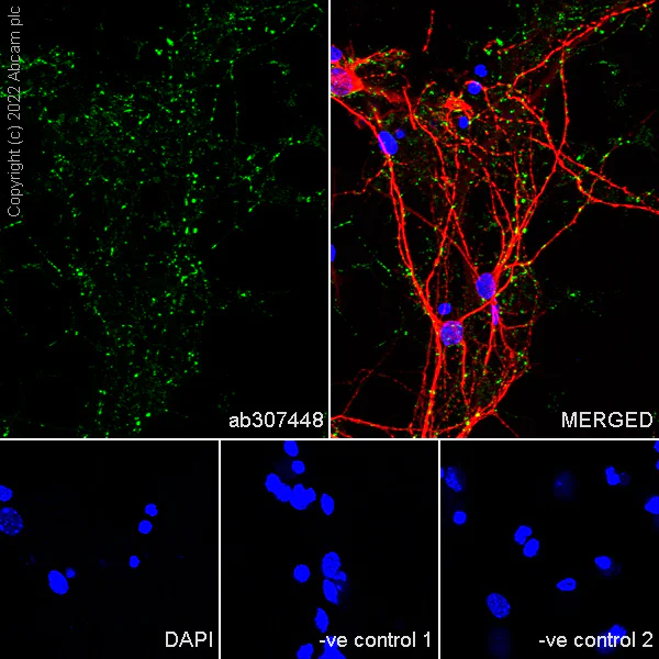 Immunocytochemistry/ Immunofluorescence - Anti-SLC32A1/VGAT antibody [L118/80] (AB307448)