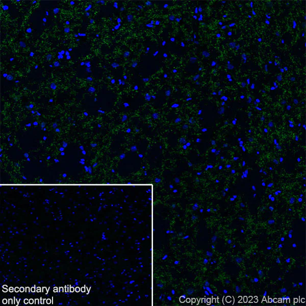 Immunohistochemistry (Frozen sections) - Anti-SLC32A1/VGAT antibody [L118/80] (AB307448)