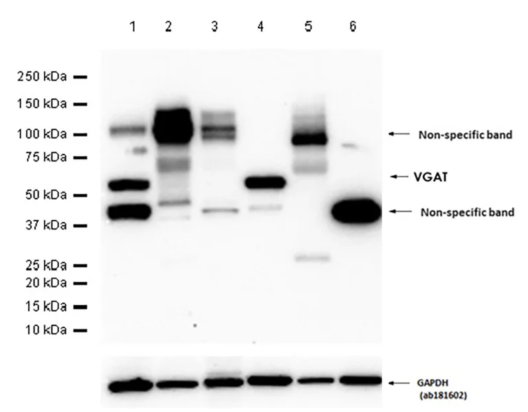Western blot - Anti-SLC32A1/VGAT antibody [L118/80] (AB307448)