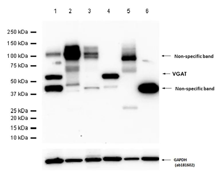 Western blot - Anti-SLC32A1/VGAT antibody [L118/80] - BSA and Azide free (AB307449)