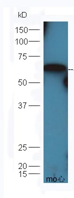Western blot - Anti-SLC33A1/AT-1 antibody (AB213680)
