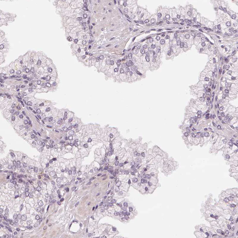 Immunohistochemistry (Formalin/PFA-fixed paraffin-embedded sections) - Anti-SLC34A1 antibody (AB151129)