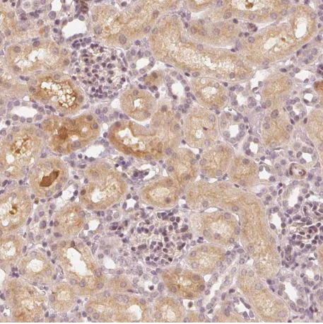 Immunohistochemistry (Formalin/PFA-fixed paraffin-embedded sections) - Anti-SLC34A1 antibody (AB151129)