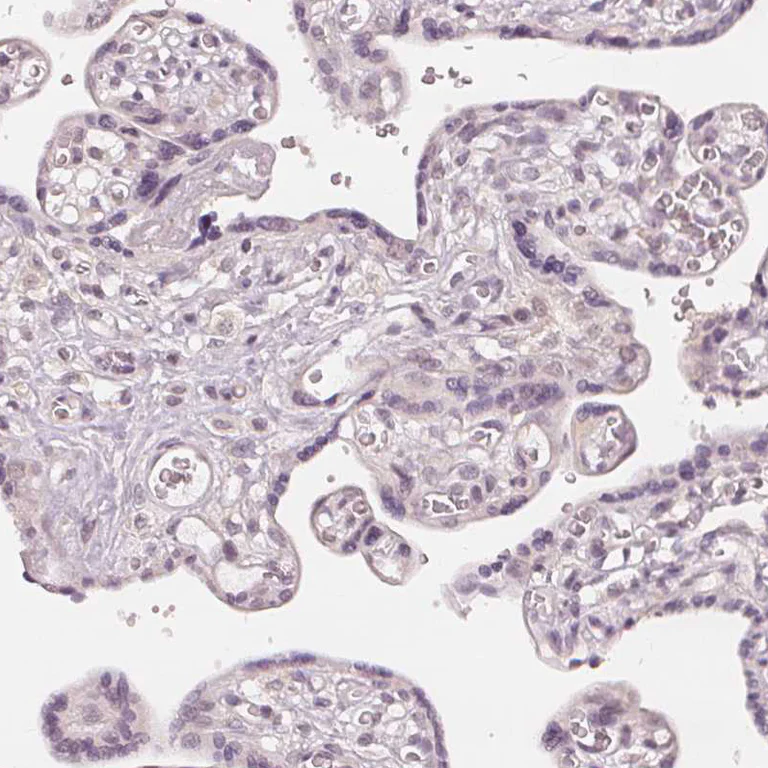 Immunohistochemistry (Formalin/PFA-fixed paraffin-embedded sections) - Anti-SLC34A1 antibody (AB151129)