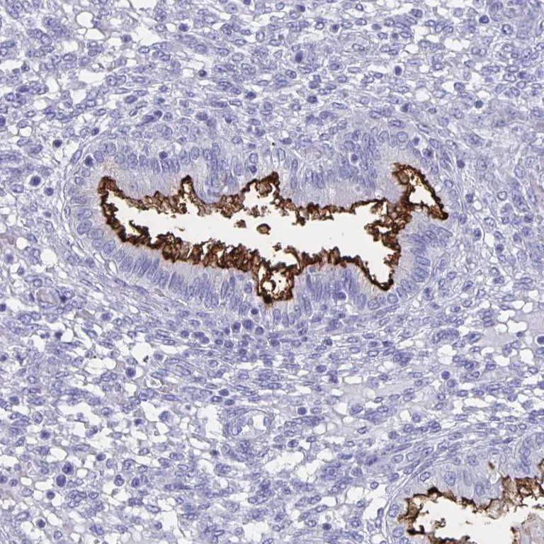 Immunohistochemistry (Formalin/PFA-fixed paraffin-embedded sections) - Anti-SLC34A2 antibody (AB122431)