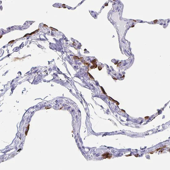 Immunohistochemistry (Formalin/PFA-fixed paraffin-embedded sections) - Anti-SLC34A2 antibody (AB122431)