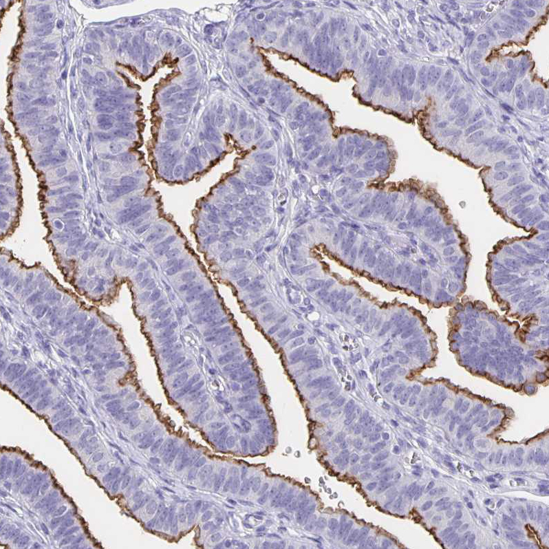Immunohistochemistry (Formalin/PFA-fixed paraffin-embedded sections) - Anti-SLC34A2 antibody (AB122431)