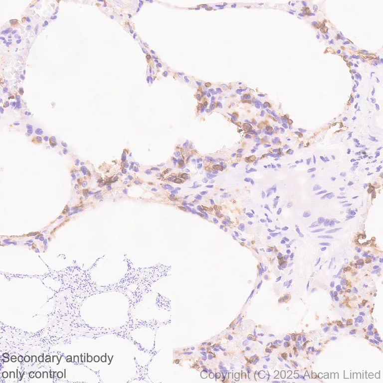 Immunohistochemistry (Formalin/PFA-fixed paraffin-embedded sections) - Anti-SLC34A2 antibody [EPR30528-645] (AB325747)