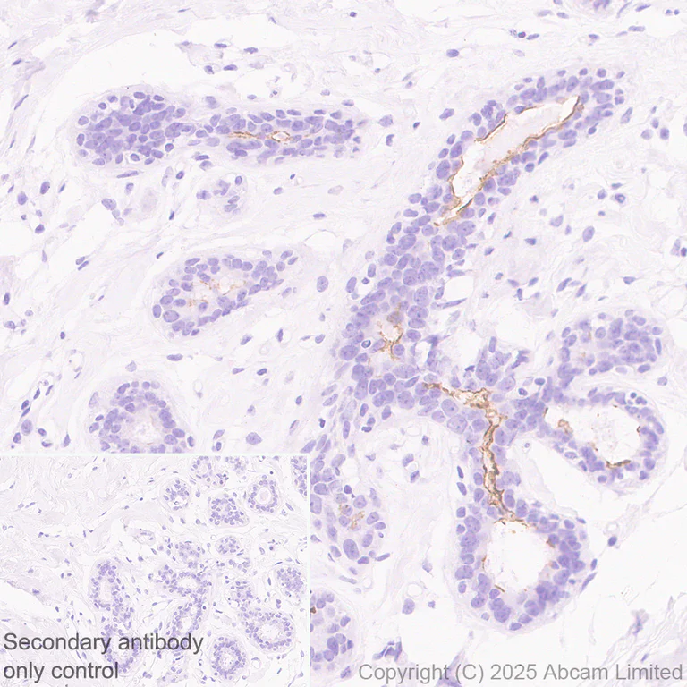 Immunohistochemistry (Formalin/PFA-fixed paraffin-embedded sections) - Anti-SLC34A2 antibody [EPR30528-645] (AB325747)