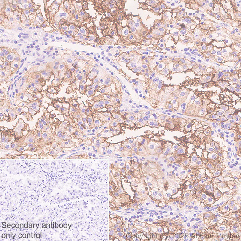 Immunohistochemistry (Formalin/PFA-fixed paraffin-embedded sections) - Anti-SLC34A2 antibody [EPR30528-645] (AB325747)