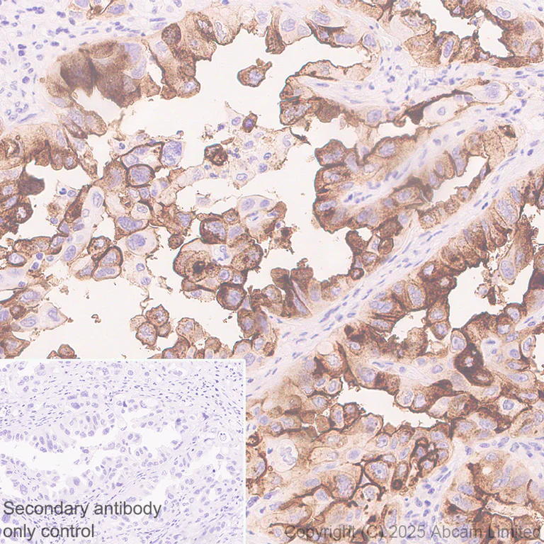 Immunohistochemistry (Formalin/PFA-fixed paraffin-embedded sections) - Anti-SLC34A2 antibody [EPR30528-645] (AB325747)