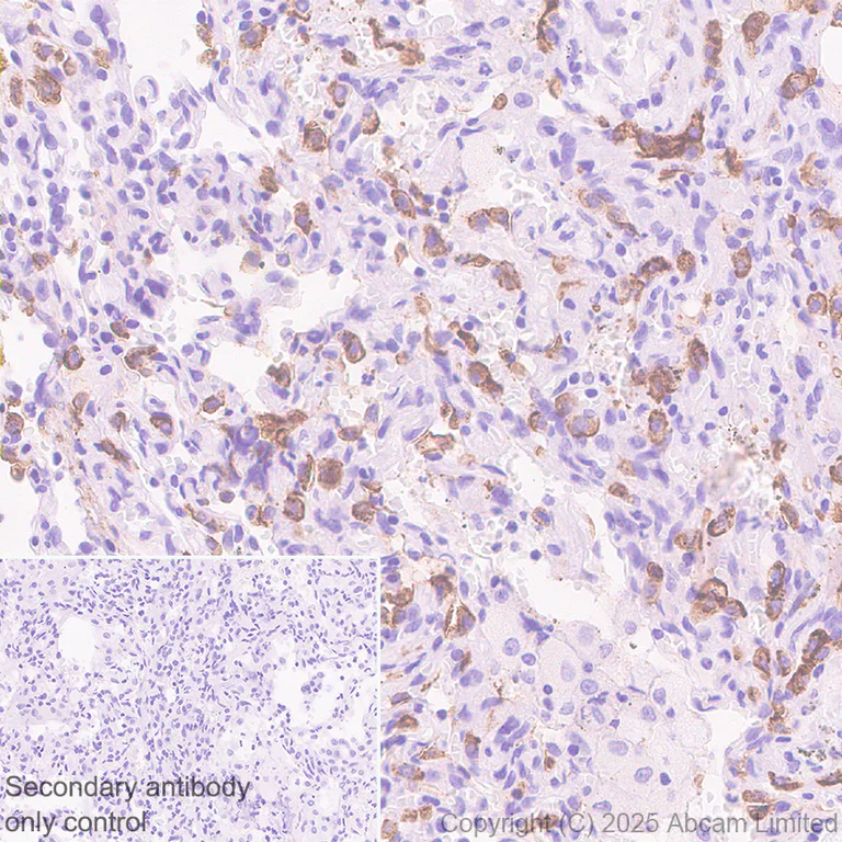 Immunohistochemistry (Formalin/PFA-fixed paraffin-embedded sections) - Anti-SLC34A2 antibody [EPR30528-645] (AB325747)