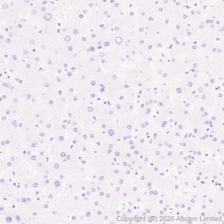 Immunohistochemistry (Formalin/PFA-fixed paraffin-embedded sections) - Anti-SLC34A2 antibody [EPR30528-645] (AB325747)