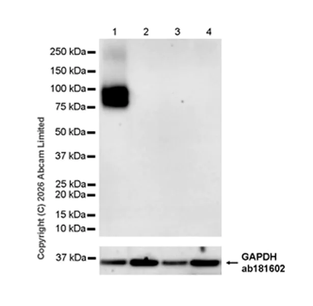 Western blot - Anti-SLC34A2 antibody [EPR30528-645] (AB325747)