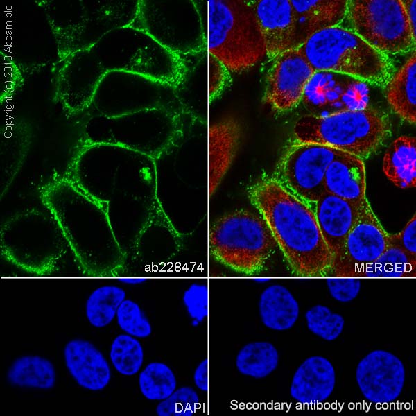 Immunocytochemistry/ Immunofluorescence - Anti-SLC34A2 antibody [SP322] - BSA and Azide free (AB238793), expandable thumbnail