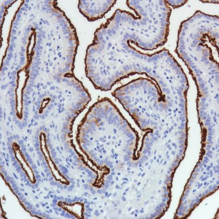 Immunohistochemistry (Formalin/PFA-fixed paraffin-embedded sections) - Anti-SLC34A2 antibody [SP322] - BSA and Azide free (ab238793), expandable thumbnail