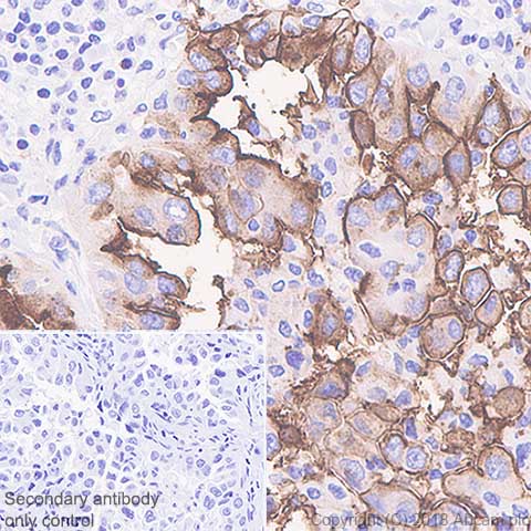 Immunohistochemistry (Formalin/PFA-fixed paraffin-embedded sections) - Anti-SLC34A2 antibody [SP322] - BSA and Azide free (AB238793), expandable thumbnail