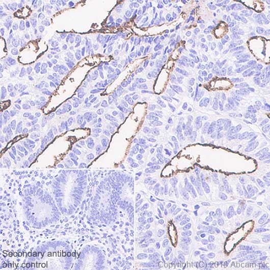 Immunohistochemistry (Formalin/PFA-fixed paraffin-embedded sections) - Anti-SLC34A2 antibody [SP322] - BSA and Azide free (AB238793), expandable thumbnail