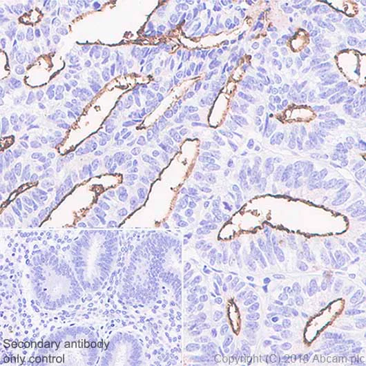 Immunohistochemistry (Formalin/PFA-fixed paraffin-embedded sections) - Anti-SLC34A2 antibody [SP322] - BSA and Azide free (AB238793)