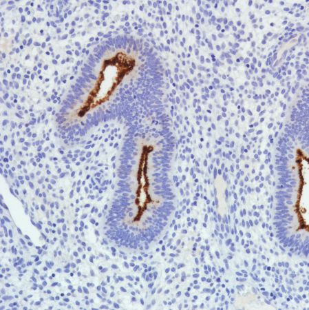 Immunohistochemistry (Formalin/PFA-fixed paraffin-embedded sections) - Anti-SLC34A2 antibody [SP322] - BSA and Azide free (ab238793), expandable thumbnail