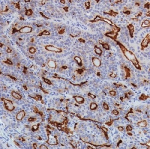 Immunohistochemistry (Formalin/PFA-fixed paraffin-embedded sections) - Anti-SLC34A2 antibody [SP322] - BSA and Azide free (ab238793), expandable thumbnail