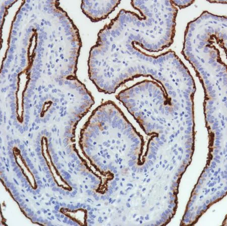 Immunohistochemistry (Formalin/PFA-fixed paraffin-embedded sections) - Anti-SLC34A2 antibody [SP322] - N-terminal (AB228474)