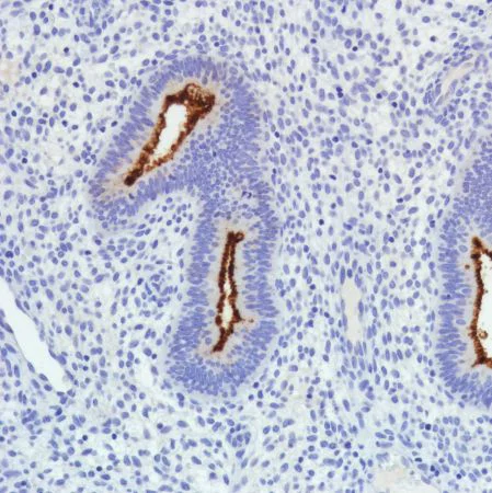 Immunohistochemistry (Formalin/PFA-fixed paraffin-embedded sections) - Anti-SLC34A2 antibody [SP322] - N-terminal (AB228474)