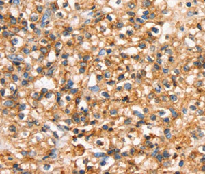 Immunohistochemistry (Formalin/PFA-fixed paraffin-embedded sections) - Anti-SLC34A3 antibody (AB198714)