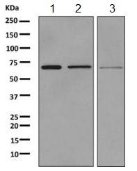 Western blot - Anti-SLC34A3 antibody [EPR9588] (AB155986)